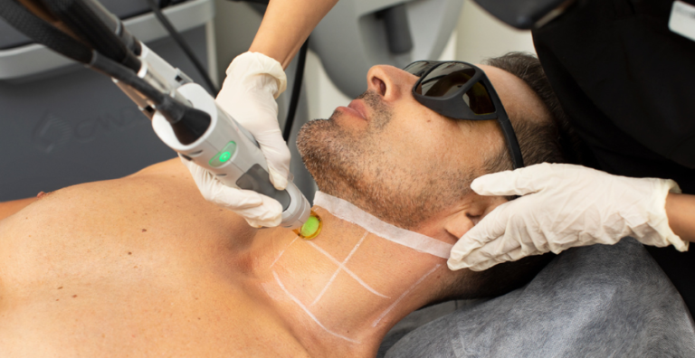 Laser Hair Reduction