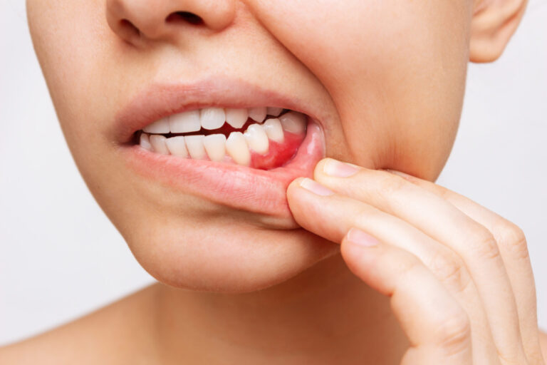 Role of Dentists in Treating Gum Disease