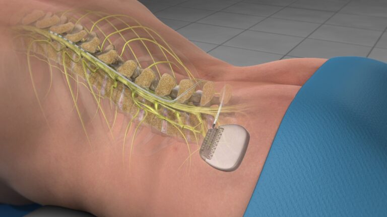 Treat Spinal Pain
